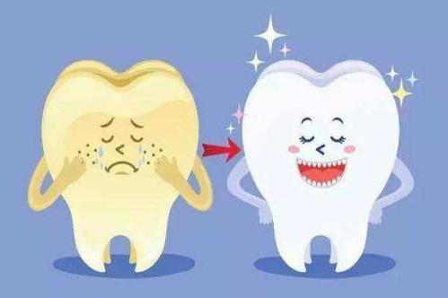​目前最火的牙齿美白手段 牙医才懂的牙齿美白利与弊
