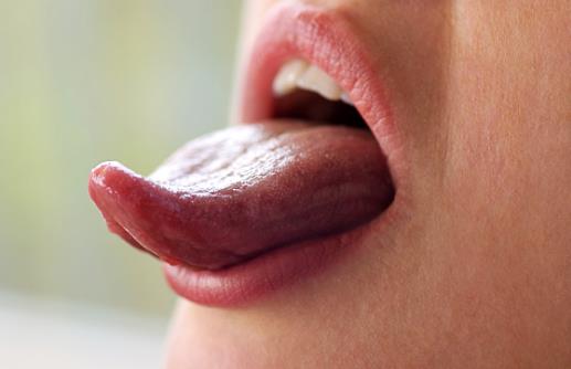 ​舌苔又黄又厚并非健康的舌头 舌苔黄厚的饮食疗方