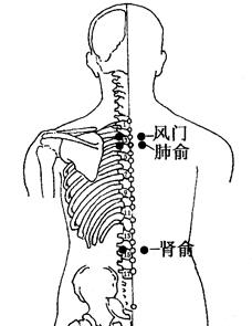 肺气肿的拔罐疗法[图]