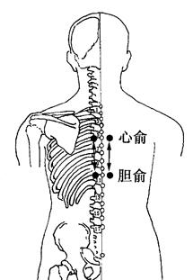 惊悸的拔罐疗法[图]