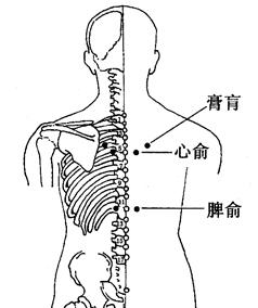 健忘的拔罐疗法[图]