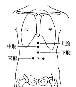 慢性胃炎的拔罐疗法[图]