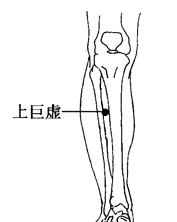 泄泻的拔罐疗法[图]